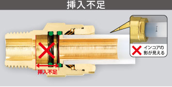 挿入不足